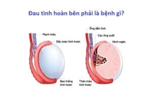 Nguyên nhân đau tinh hoàn bên phải | 5 triệu chứng thường gặp