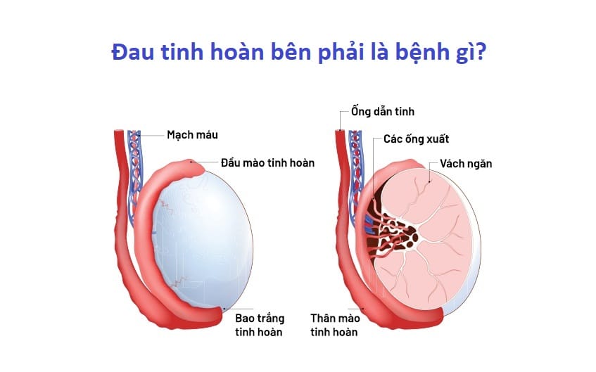 Đau tinh hoàn bên phải là bệnh gì? Dấu hiệu & cách điều trị