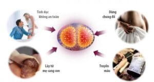 Bệnh lậu lây qua đường nào? 3 Con đường chính bạn cần biết