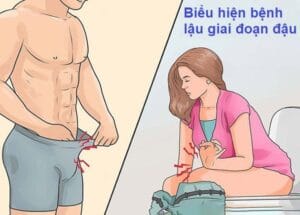 Bệnh lậu giai đoạn đầu: Những biểu hiện và triệu chứng cần lưu ý