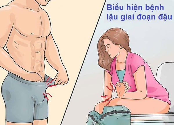 Bệnh lậu giai đoạn đầu: Những biểu hiện và triệu chứng cần lưu ý 1 Biểu hiện bệnh lậu giai đoạn đầu