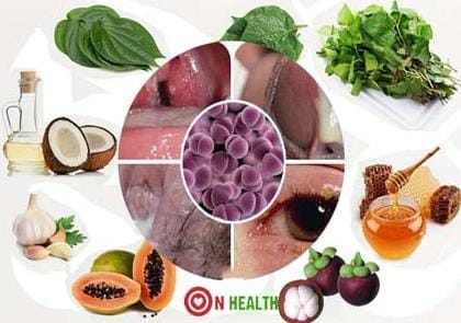 Cách Chữa Bệnh Lậu Ở Nam Giới: Hiệu Quả, Chi Tiết Và Dễ Áp Dụng 2 Chữa bệnh lậu bằng thuốc nam