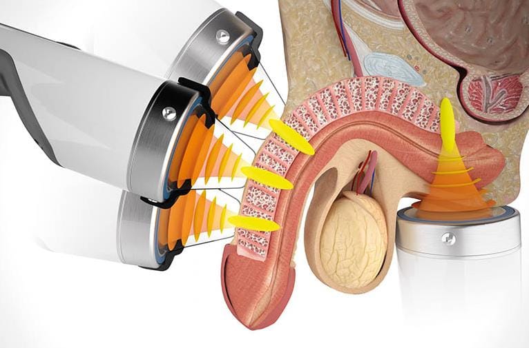 Điều trị rối loạn cương dương ở Phú Thọ | Phòng Khám Đa Khoa Tân Thành 1 Chữa rối loạn cương dương ở Phú Thọ | Phòng Khám Đa Khoa Tân Thành
