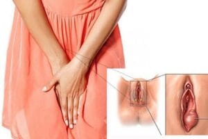 Môi lớn bị sưng: Nguyên nhân & cách xử lý chị em cần biết