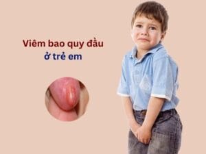 Viêm bao quy đầu ở trẻ: Nguyên nhân & cách xử lý