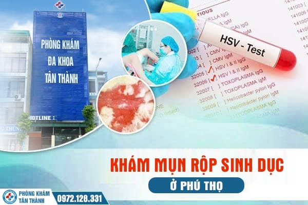 Địa chỉ khám mụn rộp sinh dục ở Phú Thọ uy tín 1 Khám mụn rộp sinh dục ở Phú Thọ | Phòng Khám Đa Khoa Tân Thành